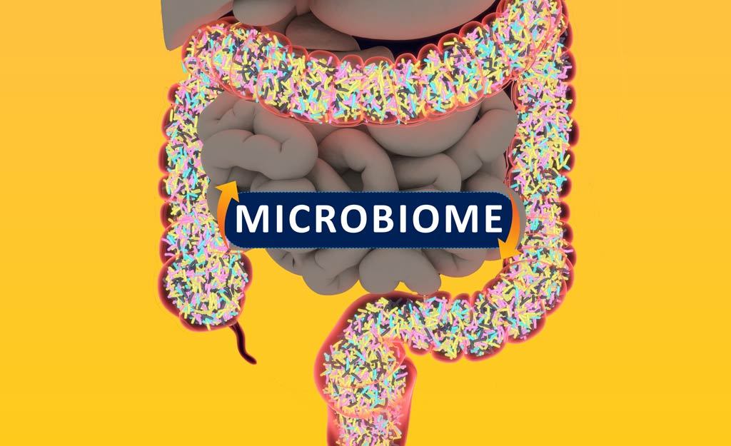 Is your gut health stopping you from losing weight?
