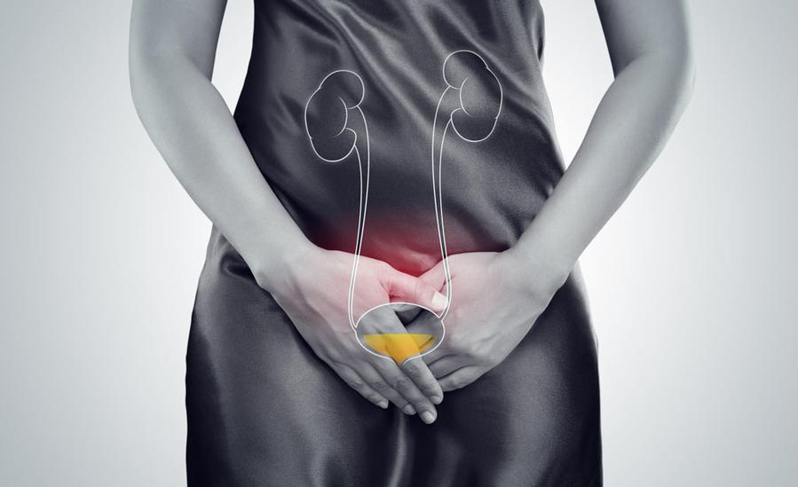 What is Urinary Incontinence?