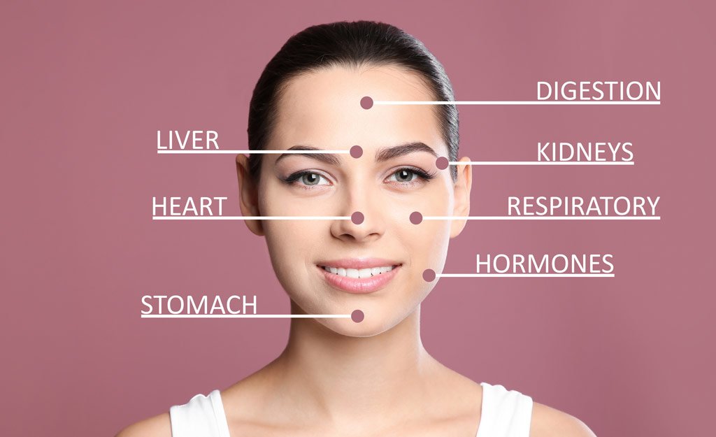 What Your Acne Says About Your Health
